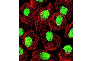 Fluorescent confocal image of U251 cell stained wit. (Nucleolin Antikörper  (AA 276-304))