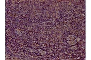 Immunohistochemistry (IHC) image for anti-CD14 (CD14) (AA 20-345) antibody (ABIN7160185)