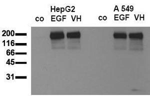 Western Blotting (WB) image for anti-Epidermal Growth Factor Receptor (EGFR) (pTyr869) antibody (ABIN126761) (EGFR Antikörper  (pTyr869))
