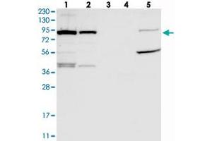 Western blot analysis of Lane 1: RT-4, Lane 2: U-251 MG, Lane 3: Human Plasma, Lane 4: Liver, Lane 5: Tonsil with UFL1 polyclonal antibody  at 1:250-1:500 dilution.