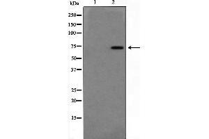 Western blot analysis on Jurkat cell lysate using DUSP16 Antibody,The lane on the left is treated with the antigen-specific peptide.