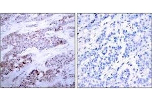 Immunohistochemistry (IHC) image for anti-Activating Transcription Factor 4 (Tax-Responsive Enhancer Element B67) (ATF4) (AA 212-261), (pSer245) antibody (ABIN1531779)