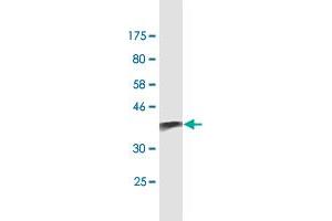 Western Blot detection against Immunogen (38. (S100A9 Antikörper  (AA 1-114))