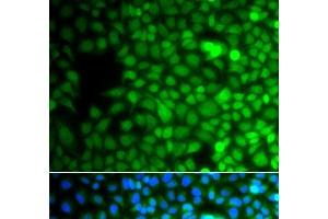 Immunofluorescence analysis of A549 cells using ZNF195 Polyclonal Antibody (ZNF195 Antikörper)