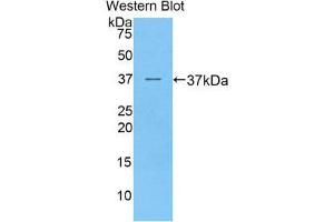 Western Blotting (WB) image for anti-Preferentially Expressed Antigen in Melanoma (PRAME) (AA 416-502) antibody (ABIN1860297) (PRAME Antikörper  (AA 416-502))