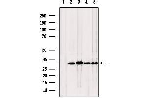 Western blot analysis of extracts from various samples, using TPI1 antibody. (TPI1 Antikörper  (C-Term))