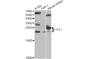 Western blot analysis of extracts of various cell lines, using TPT1 antibody. (TPT1 Antikörper)