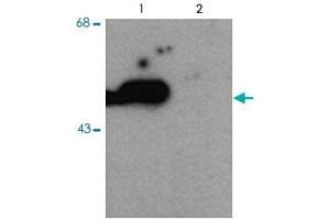 Western blot of HEK293 cells transfected with PARK2 WT (Phospho) and PARK2 S101 mutant (non-phospho) showing the phospho-specific immunolabeling of the ~ 52 k parkin protein. (Parkin Antikörper  (pSer101))
