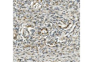 IHC analysis of SGK1 using anti-SGK1 antibody (ABIN7603118). (SGK1 Antikörper  (N-Term))