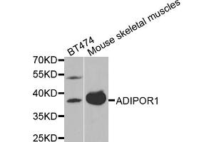 Western blot analysis of extracts of various cell lines, using ADIPOR1 antibody (ABIN5970705) at 1/1000 dilution. (Adiponectin Receptor 1 Antikörper)