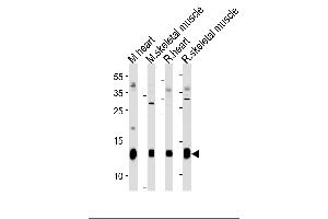 PLM Antibody (E1) (ABIN1882173 and ABIN2844827) western blot analysis in mouse heart,skeletal muscle and rat heart,skeletal muscle tissue lysates (35 μg/lane).