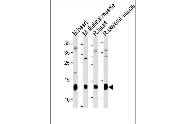 FXYD1 anticorps  (N-Term)