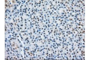 Immunohistochemical staining of paraffin-embedded Human colon tissue using anti-H6PD mouse monoclonal antibody. (Glucose-6-Phosphate Dehydrogenase Antikörper)