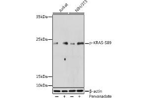 Western blot analysis of extracts of various cell lines, using Phospho-KRAS-S89 Rabbit pAb (ABIN7267530) at 1:500 dilution. (K-RAS Antikörper  (pSer89))