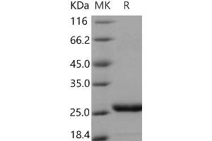 Prolactin Protein (PRL) (His tag)