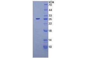 SDS-PAGE analysis of Rat XPC Protein. (XPC Protein)