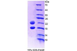 SDS-PAGE analysis of Human AVPI1 Protein. (AVPI1 Protein)