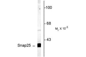 Image no. 1 for anti-Synaptosomal-Associated Protein, 25kDa (SNAP25) (C-Term) antibody (ABIN372714) (SNAP25 Antikörper  (C-Term))