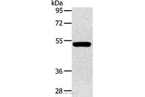 Western blot analysis of Human fetal muscle tissue, using GJA9 Polyclonal Antibody at dilution of 1:400 (GJA9 Antikörper)