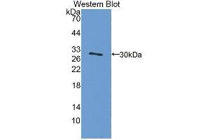 Western blot analysis of the recombinant protein. (PIBF1 Antikörper  (AA 13-203))