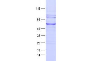 Validation with Western Blot