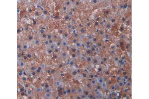 Used in DAB staining on fromalin fixed paraffin- embedded kidney tissue (CYP17A1 Antikörper  (AA 201-507))