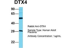 Host: Rabbit  Target Name: DTX4  Sample Tissue: Human Adult Placenta  Antibody Dilution: 1.