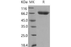 SERPIND1 Protein (His tag)