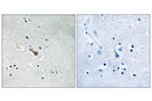Immunohistochemistry (IHC) image for anti-Amyloid beta (A4) Precursor-Like Protein 2 (APLP2) (pTyr755) antibody (ABIN5976088) (APLP2 Antikörper  (pTyr755))