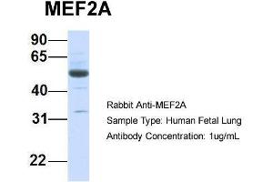 Host:  Rabbit  Target Name:  MEF2A  Sample Type:  Human Fetal Lung  Antibody Dilution:  1.
