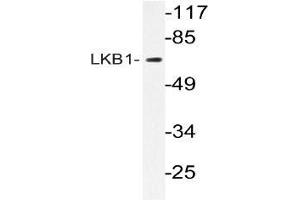 Western blot (WB) analyzes of LKB1 antibody in extracts from CV-1cells. (LKB1 Antikörper)