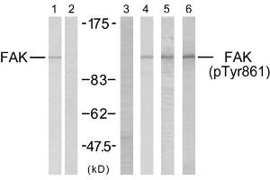 Western blot analysis using FAK (Ab-861) antibody (E021076, Lane 1 and 2) and FAK (phospho-Tyr861) antibody (E011059, Lane 3, 4, 5 and 6). (FAK Antikörper)