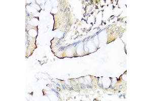 Immunohistochemistry of paraffin-embedded human colon using NRG4 antibody (ABIN1873958) at dilution of 1:100 (40x lens). (Neuregulin 4 Antikörper)