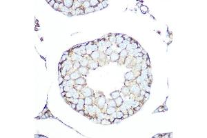 Immunohistochemistry of paraffin-embedded rat testis using SSTR5 Rabbit mAb (ABIN7270495) at dilution of 1:100 (40x lens). (SSTR5 Antikörper)
