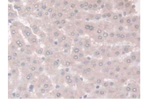 IHC-P analysis of Rat Liver Tissue, with DAB staining.