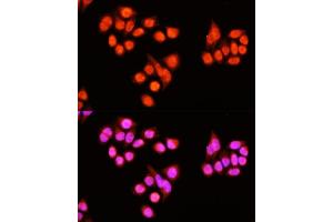 Immunofluorescence analysis of Hela cells using ZNF408 antibody  at dilution of 1:100 (40x lens). (ZNF408 Antikörper  (AA 1-240))