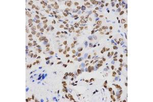 Immunohistochemistry (Paraffin-embedded Sections) (IHC (p)) image for anti-Histone H4 (2meLys20) antibody (ABIN3016048)