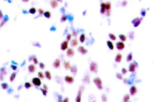 Image no. 2 for anti-Collagen, Type XVIII, alpha 1 (COL18A1) (Chain alpha 1) antibody (ABIN265401) (COL18A1 Antikörper  (Chain alpha 1))