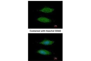 ICC/IF Image Immunofluorescence analysis of methanol-fixed HeLa, using LOC283129, antibody at 1:200 dilution. (C11orf85 Antikörper  (Center))