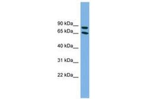 Image no. 1 for anti-Disabled Homolog 1 (Drosophila) (DAB1) (C-Term) antibody (ABIN6743635) (DAB1 Antikörper  (C-Term))