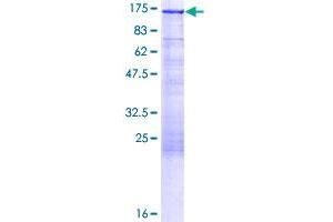 PKN1 Protein (AA 1-942) (GST tag)