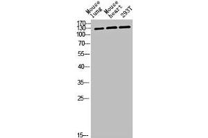 Western blot analysis of mouse-lung mouse-heart 293T lysis using CEP135 antibody. (CEP135 Antikörper  (C-Term))