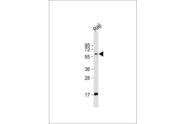 RIPK2 Antikörper  (C-Term)