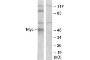 Western blot analysis of extracts from ovary cancer cells, using MYC (Ab-58) Antibody. (c-MYC Antikörper  (AA 25-74))
