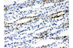 Anti-SLC9A2 antibody, IHC(P) IHC(P): Rat Kidney Tissue (SLC9A2 Antikörper  (C-Term))