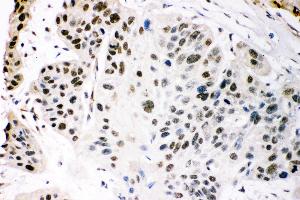 Immunohistochemistry (IHC) image for anti-E1A Binding Protein P300 (EP300) (AA 2065-2414) antibody (ABIN3042372)