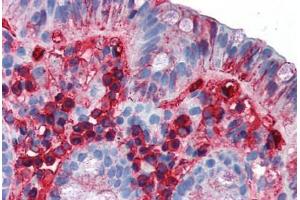 Human Colon (formalin-fixed, paraffin-embedded) stained with IgA antibody ABIN337297 at 10 ug/ml followed by biotinylated anti-mouse IgG secondary antibody ABIN481714, alkaline phosphatase-streptavidin and chromogen. (Maus anti-Human IgA Antikörper)