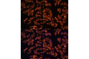 Immunofluorescence analysis of U-2 OS cells using PRX antibody (ABIN7269215) at dilution of 1:100. (Periaxin Antikörper  (AA 1250-1350))