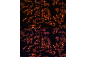 Immunofluorescence analysis of U-2 OS cells using PRX antibody (ABIN7269215) at dilution of 1:100. (Periaxin Antikörper  (AA 1250-1350))