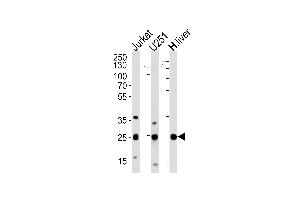 Western blot analysis of lysates from Jurkat, U251 cell line and human liver tissue (from left to right), using GSTM1 Antibody at 1:1000 at each lane.